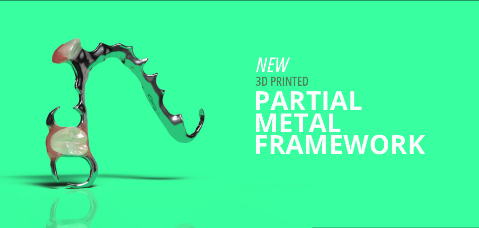 3D Pritned Partial Metal Framework