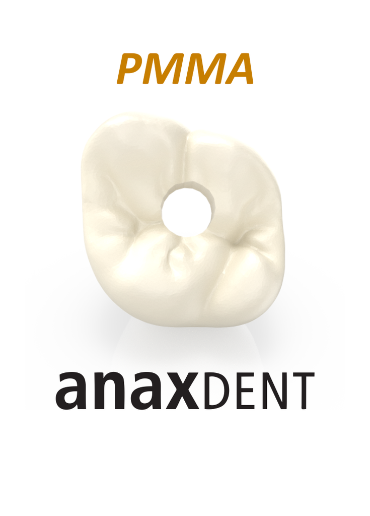 Anaxdent™ "The Show" Implant PMMA Crown